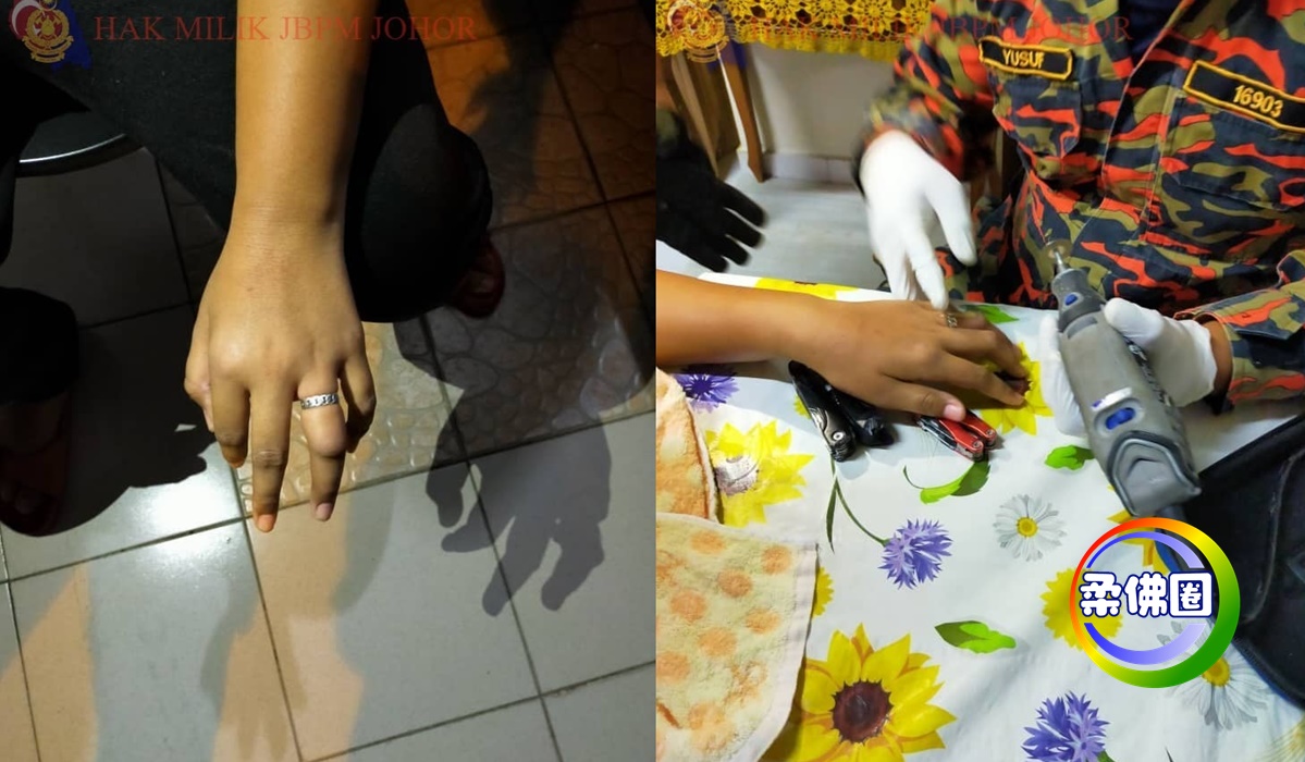 10岁男童戒指拔不出    消拯员深夜“解救无名指”