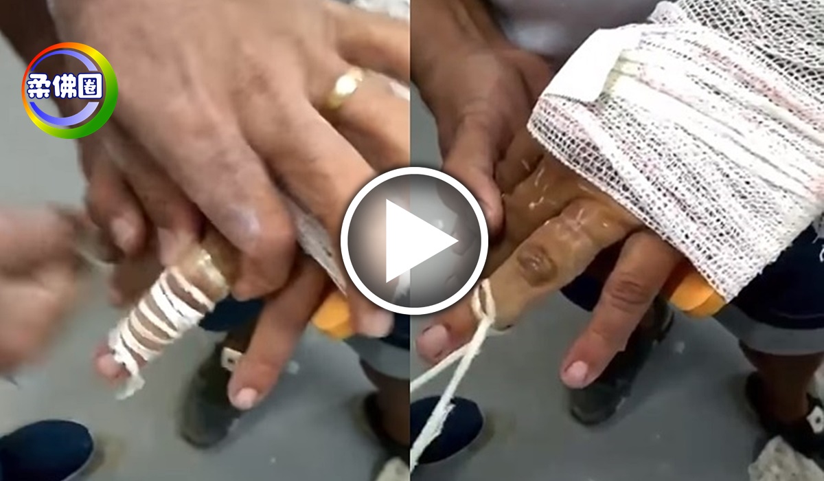 手指肿到不行 戒指脱不出来  怎么办?