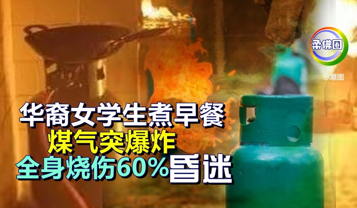 华裔女学生煮早餐   煤气突爆炸  全身烧伤60%昏迷