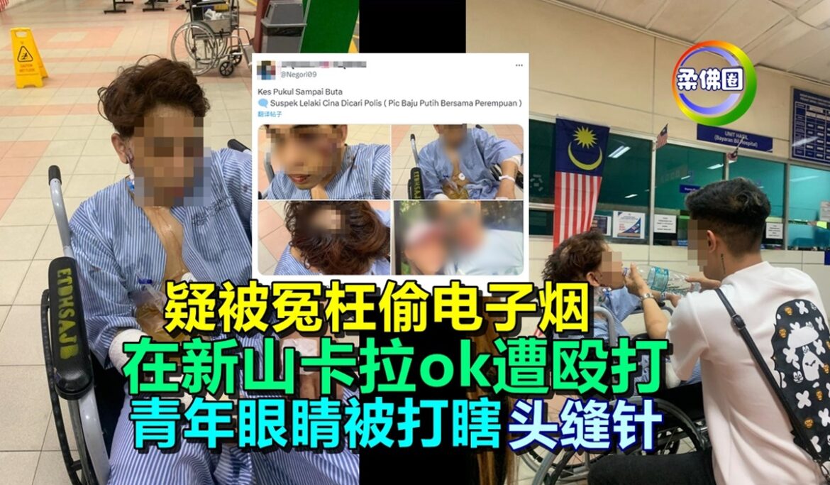 疑被冤枉偷电子烟   在新山卡拉ok遭殴打  青年眼睛被打瞎头缝针