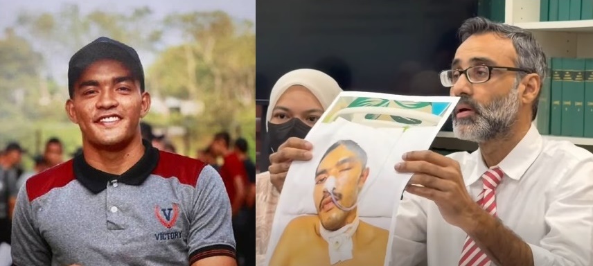 ■俊朗青年军人，被打致头颅都变形。