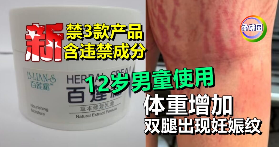 新加坡禁3款产品 含违禁成分  12岁男童使用致体重增加  双腿出现妊娠纹